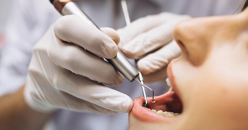 Instruments de détartrage et de polissage des dents