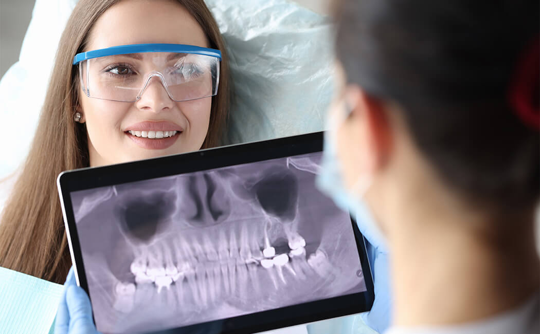 Radiographie dentaire pour diagnostiquer une rage de dents